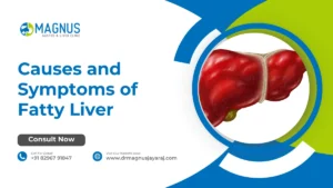 Causes and Symptoms of Fatty Liver