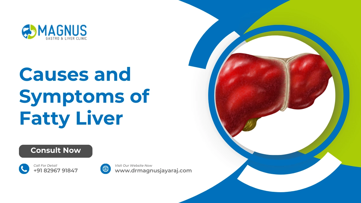 Causes and Symptoms of Fatty Liver