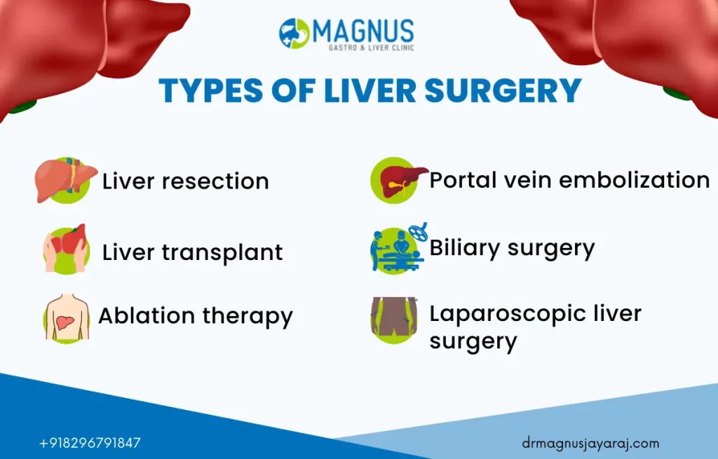 Liver Surgery in Chennai | Dr. Magnus Jayaraj