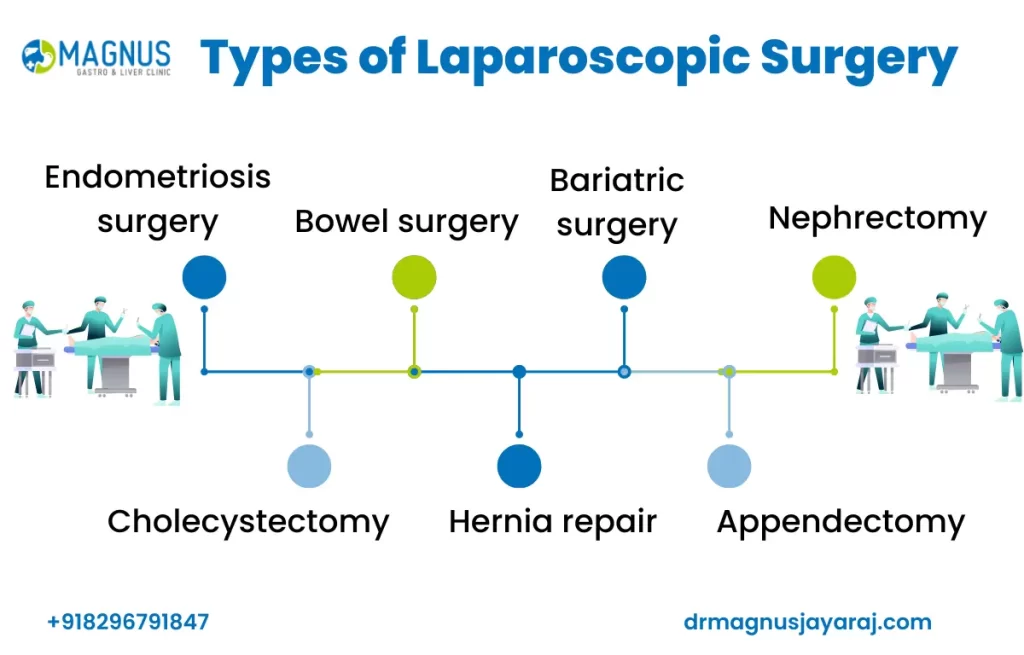 Laparoscopic Surgery in Chennai