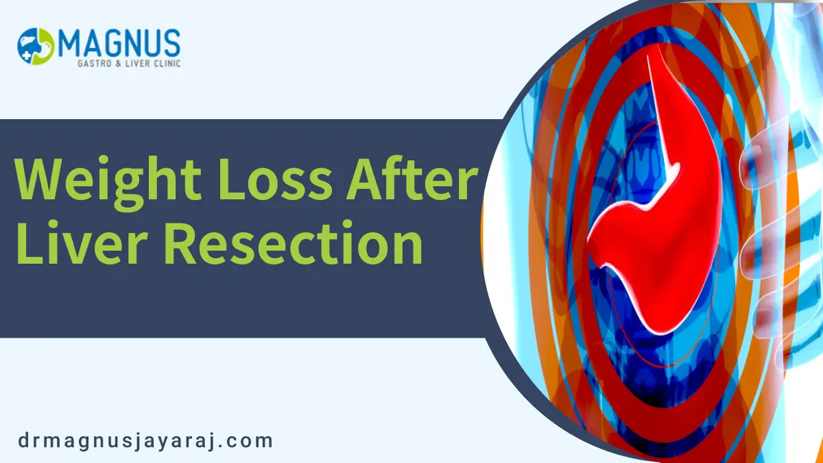 Weight Loss After Liver Resection | DrMagnusJayaraj