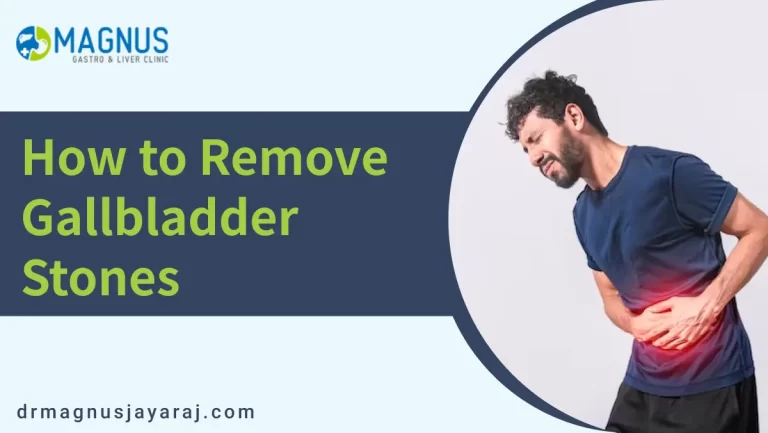 how to remove gallbladder stone | Dr. Magnus Jayaraj