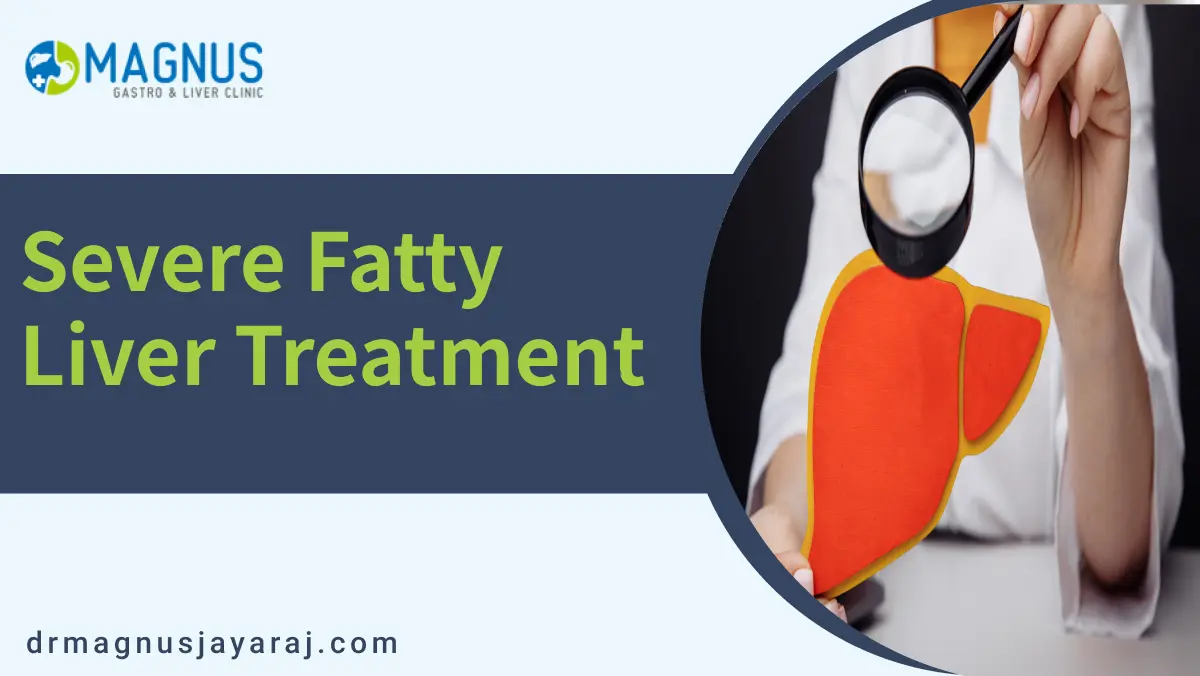 Severe Fatty Liver Treatment