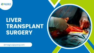 Liver Transplant Surgery