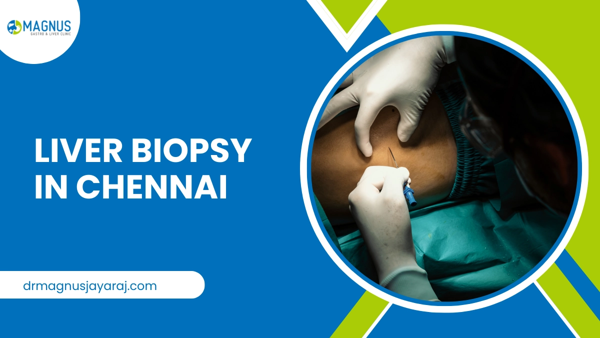 Liver Biopsy In Chennai