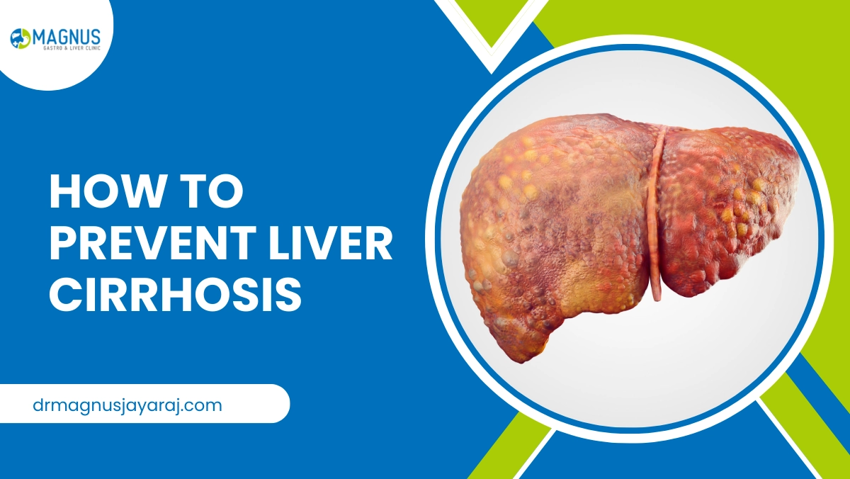 How To Prevent Liver Cirrhosis