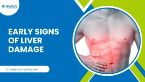 Early Signs Of Liver Damage