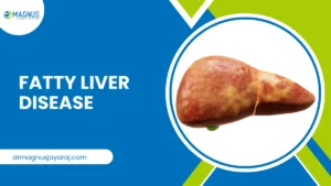 Fatty Liver Disease