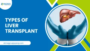 Types of Liver Transplant