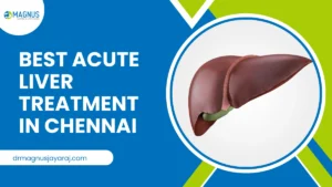 Best Acute Liver Treatment In Chennai