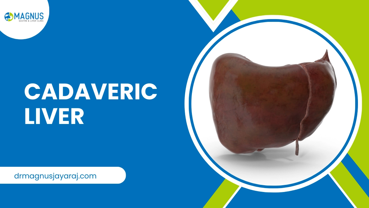 Cadaveric Liver