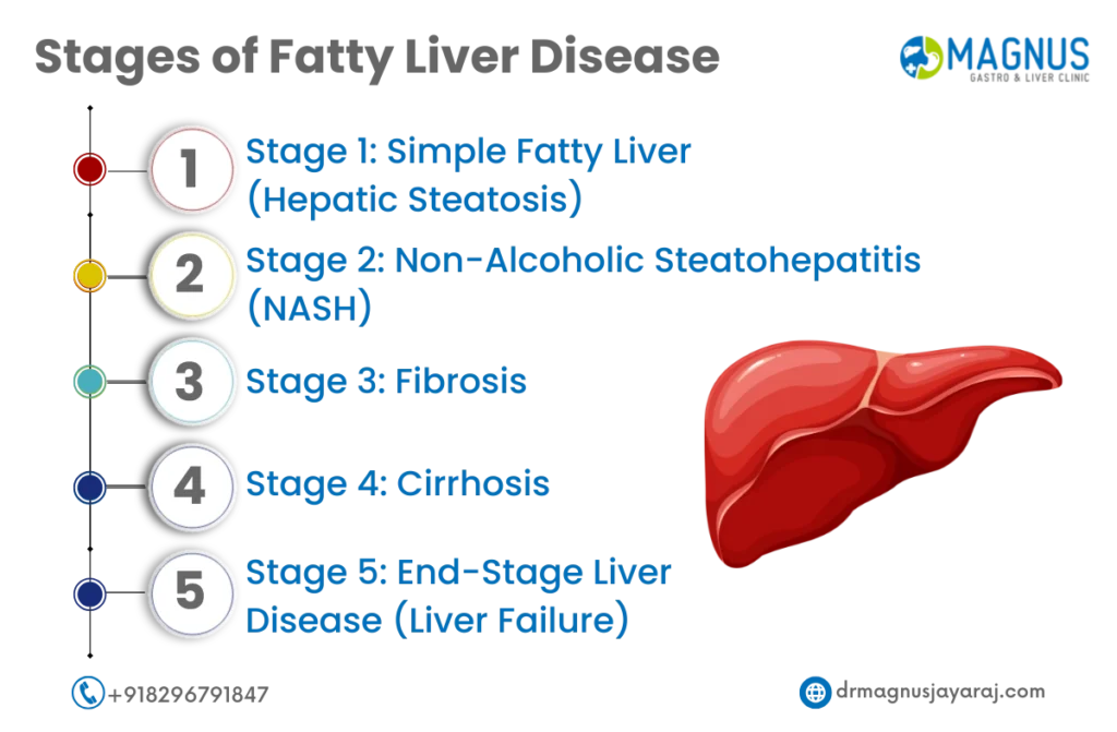 fatty liver disease