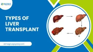 Living Donor Liver Transplant