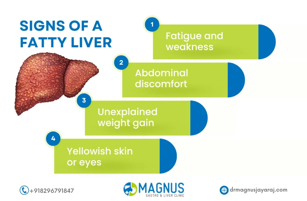 How To Detox Your Liver Naturally 