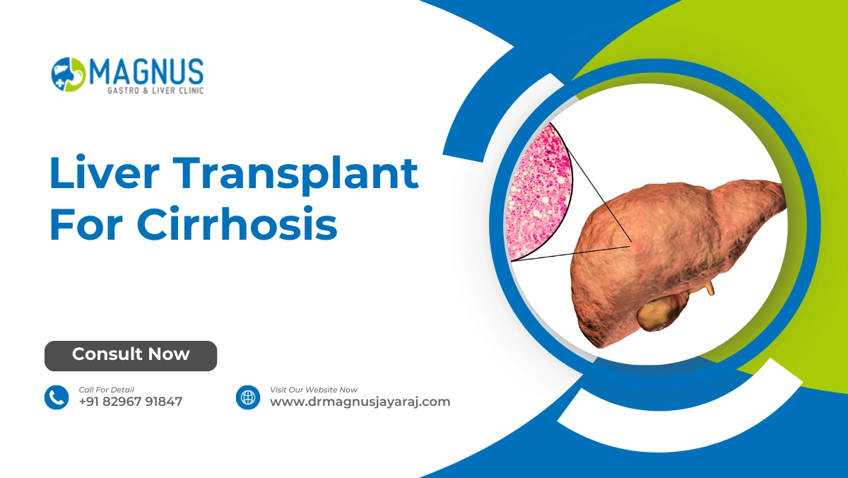Liver Transplant For Cirrhosis