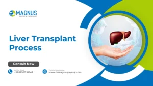 Liver Transplant Process