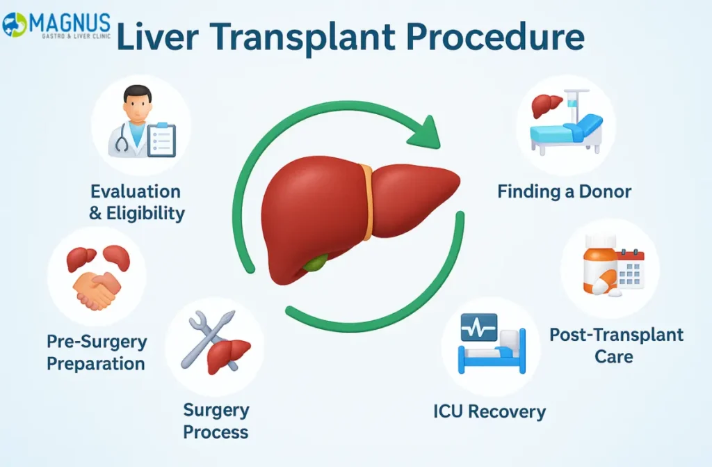 Liver Transplant Process