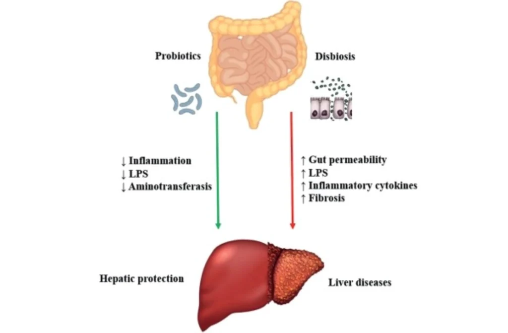 Probiotics for Liver Health