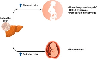 Fatty Liver While Pregnant