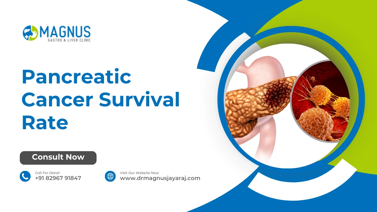 Pancreatic Cancer Survival Rate