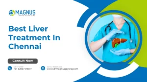 Best Liver Treatment In Chennai