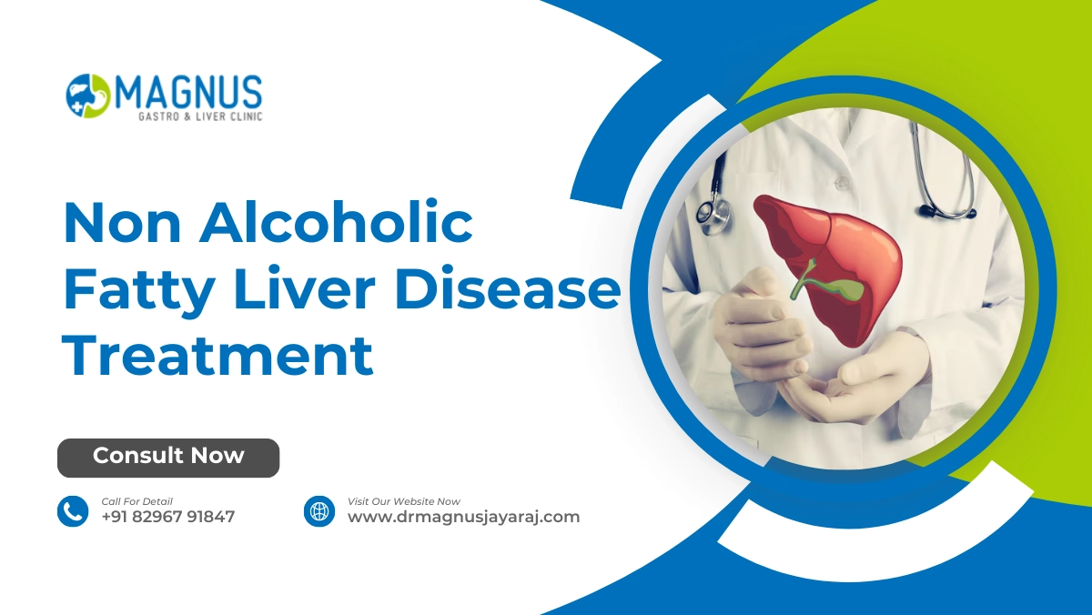 Non Alcoholic Fatty Liver Disease Treatment