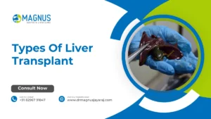 Types Of Liver Transplant