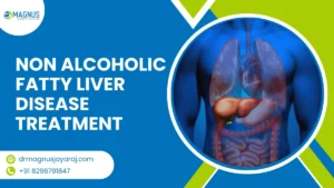 non alcoholic fatty liver disease treatment