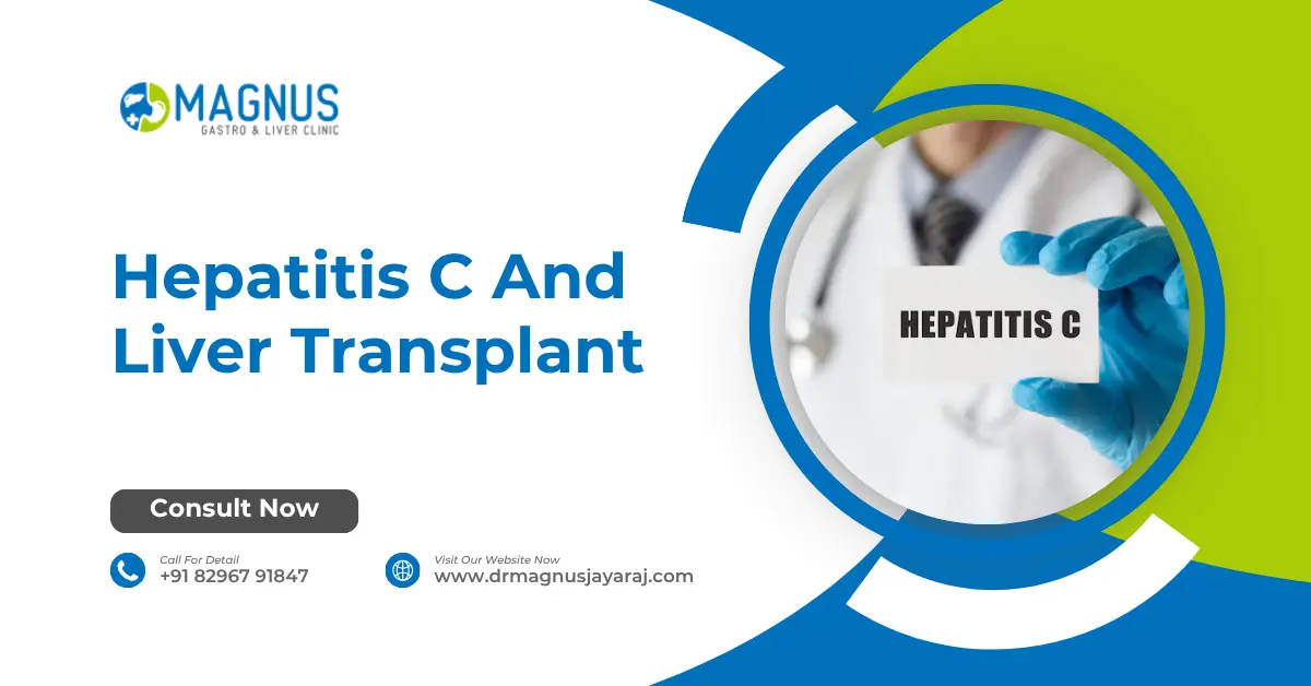 Hepatitis C And Liver Transplant