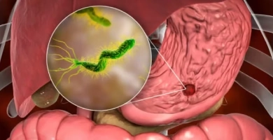 Best Gastroenterologist in India