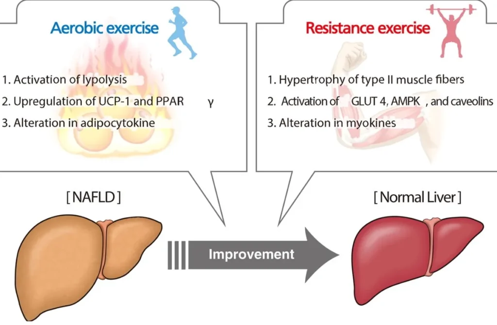 best exercise for fatty liver disease