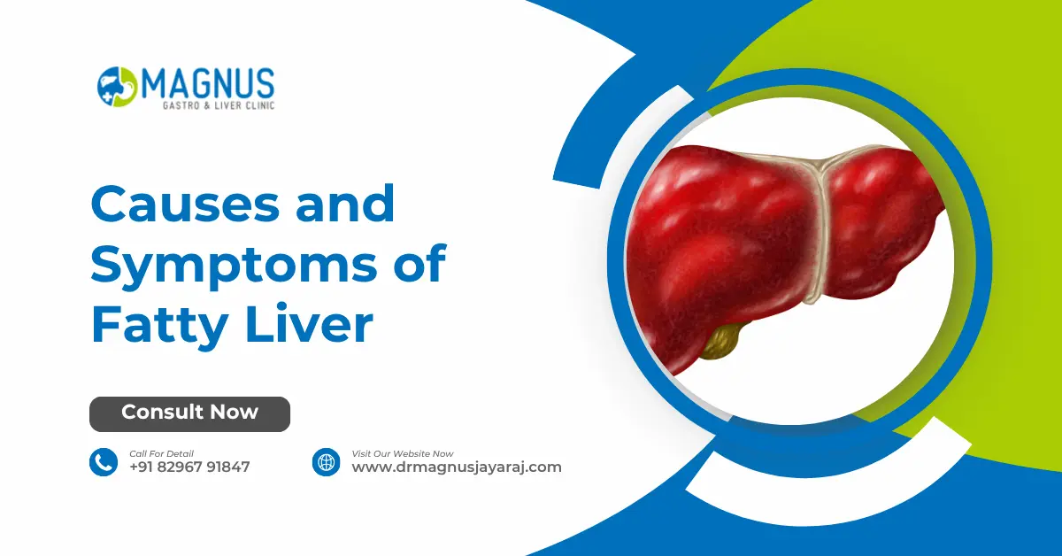 Causes and Symptoms of Fatty Liver
