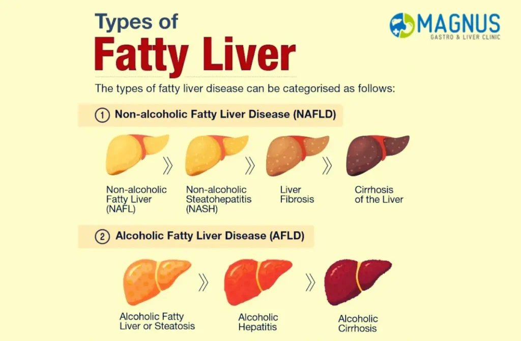 Types of Liver Disease
