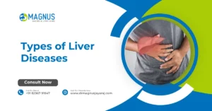 Types of Liver Disease