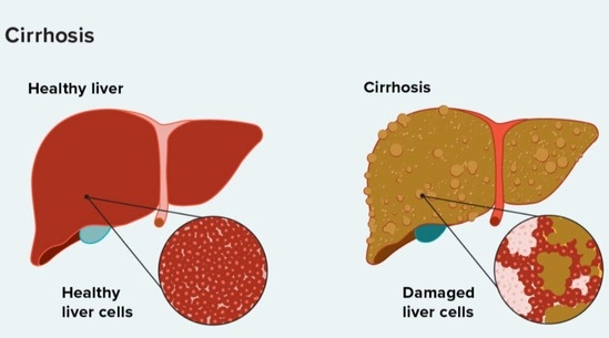 sign your liver is healing 2