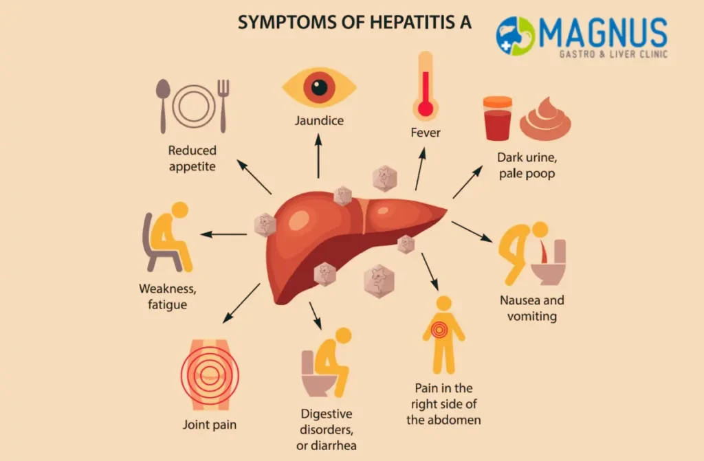 Hepatitis A Treatment and Prevention