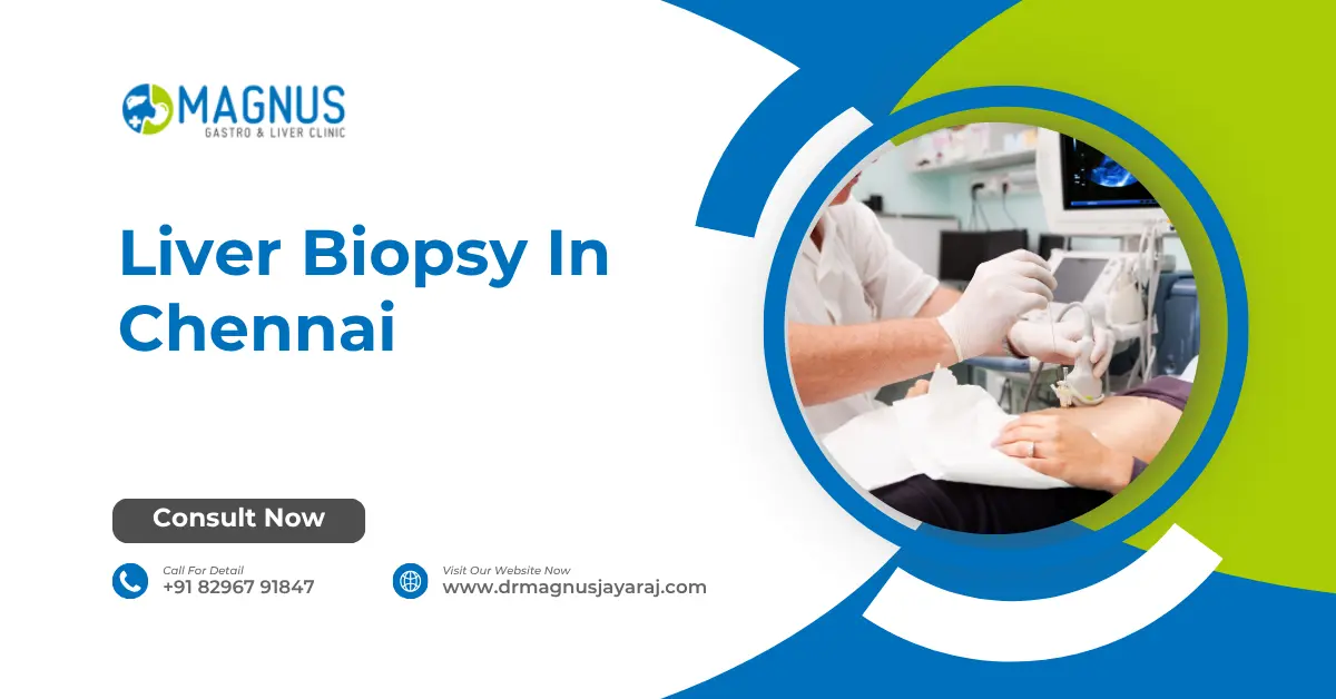 Liver Biopsy in Chennai