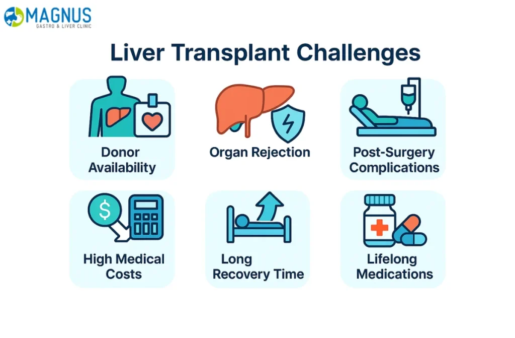 Liver Transplant Challenges In India