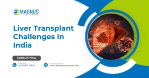 Liver Transplant Challenges In India