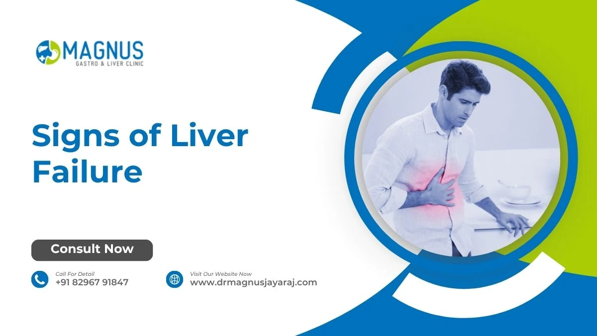 Signs of Liver Failure
