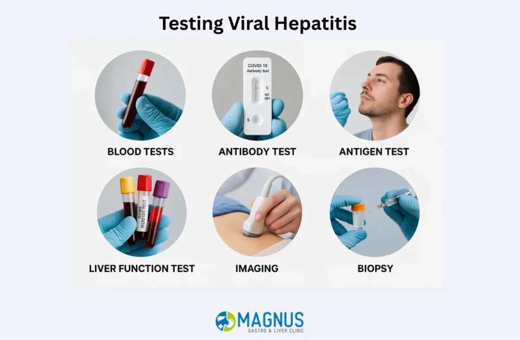 Testing For Viral Hepatitis