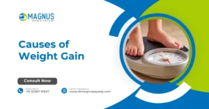 Causes of Weight Gain