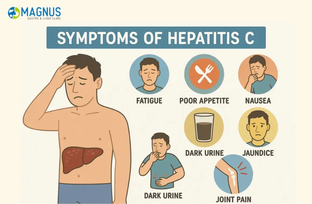 Facts About Hepatitis C