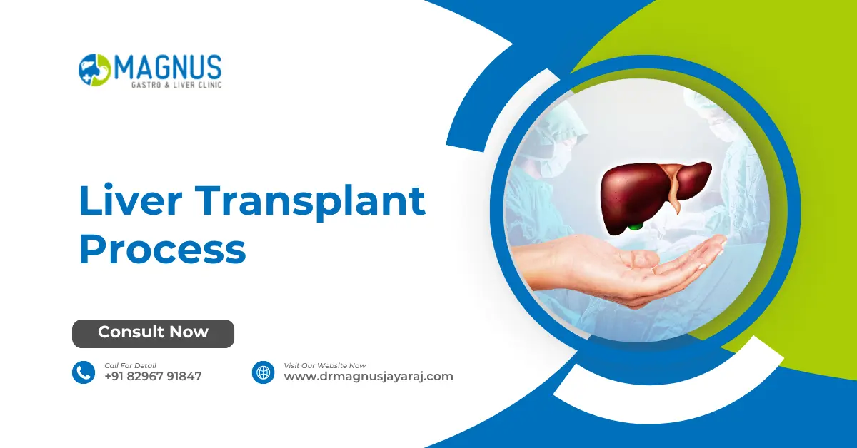 Liver Transplant Process