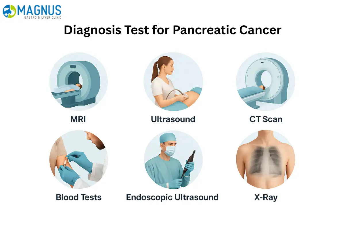 Pancreas Surgery in Chennai