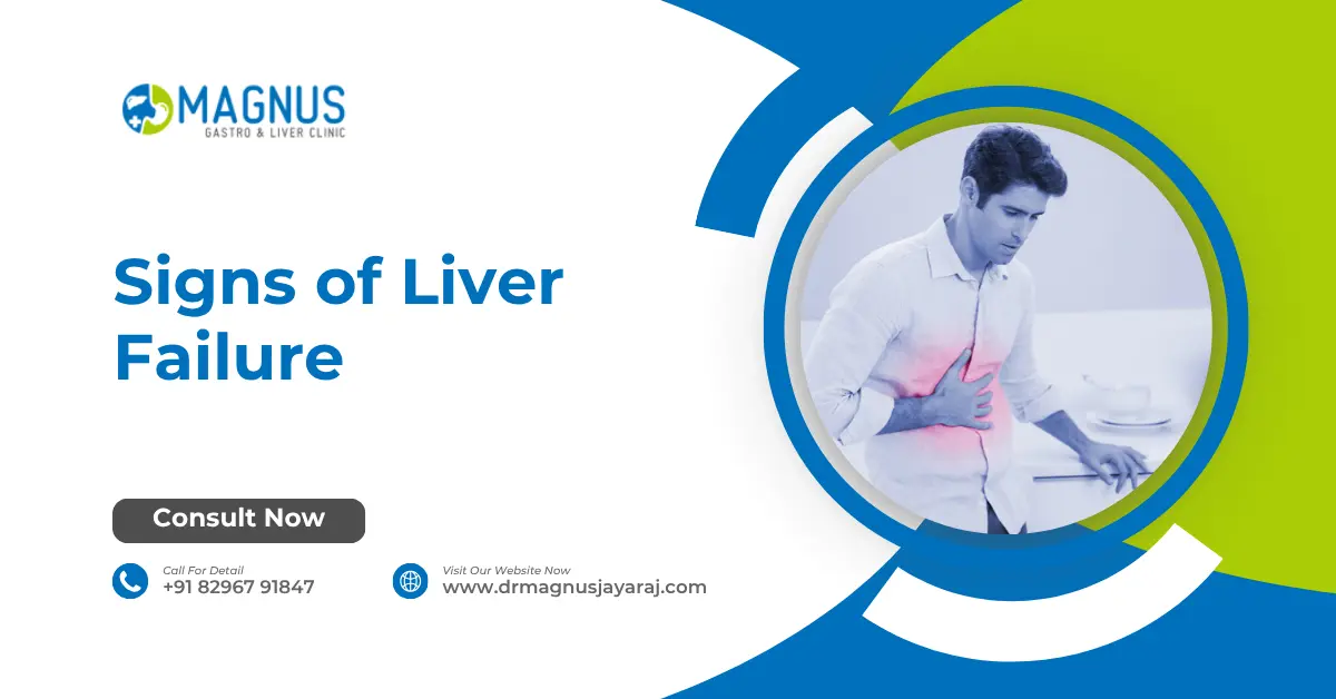 Signs of Liver Failure