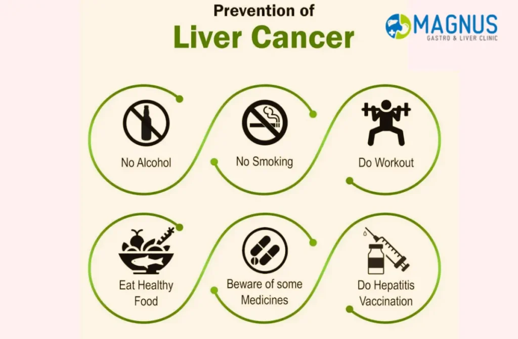 Liver Cancer Treatment in Chennai