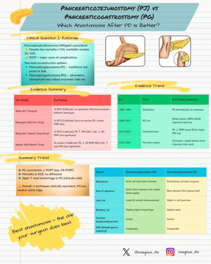 pancreaticojejunostomy